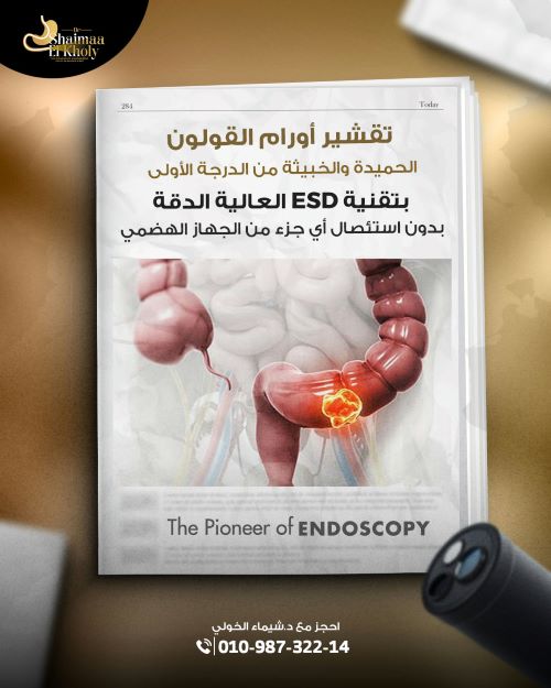 أفضل دكتور أورام القولون في مصر 